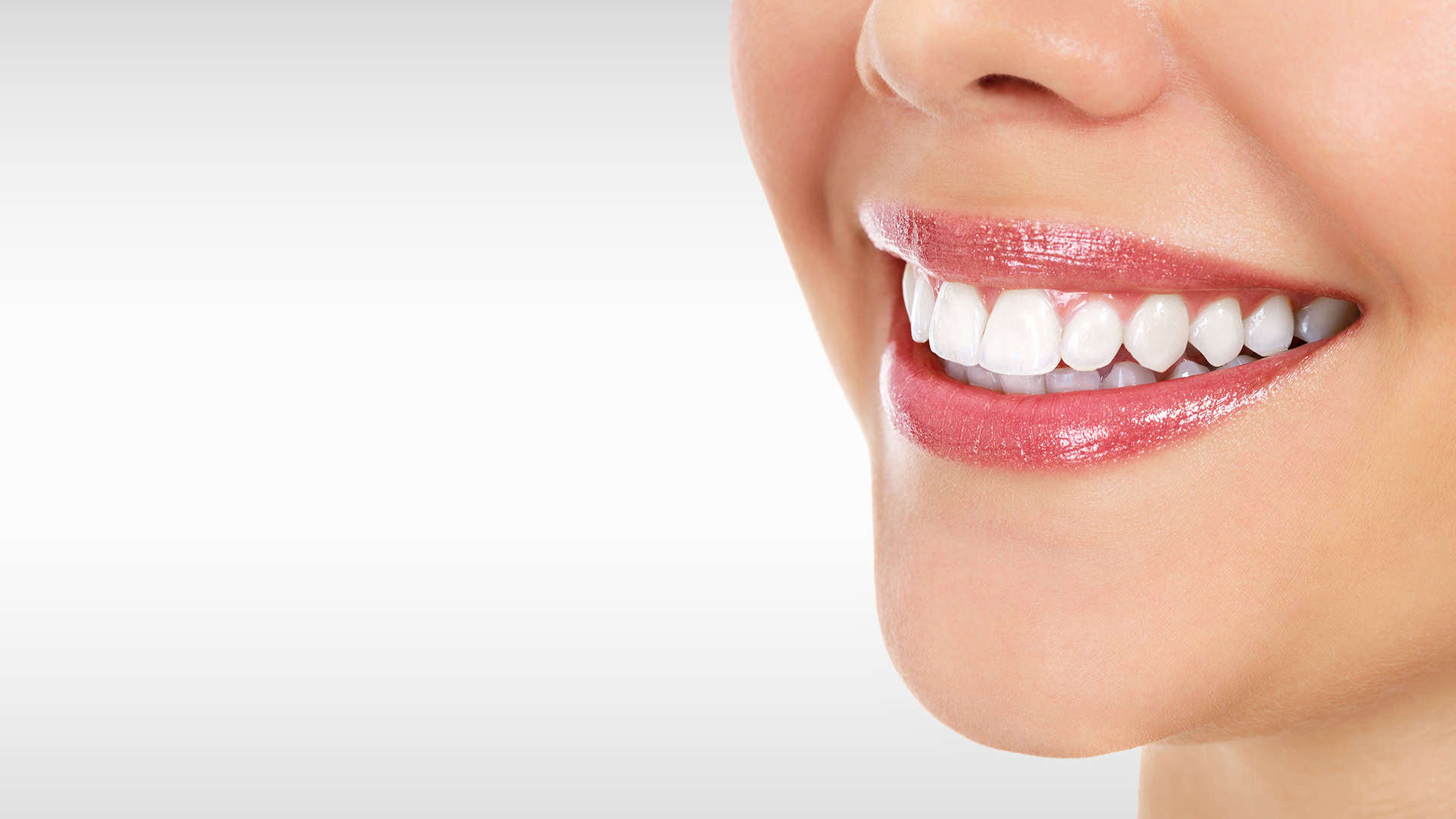 Veneers & Bonding