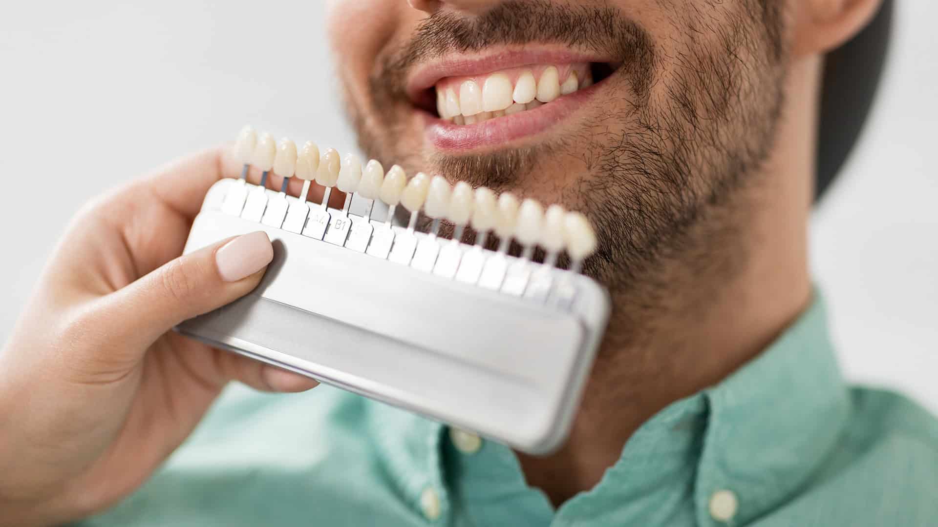 Dental Crown Color Options