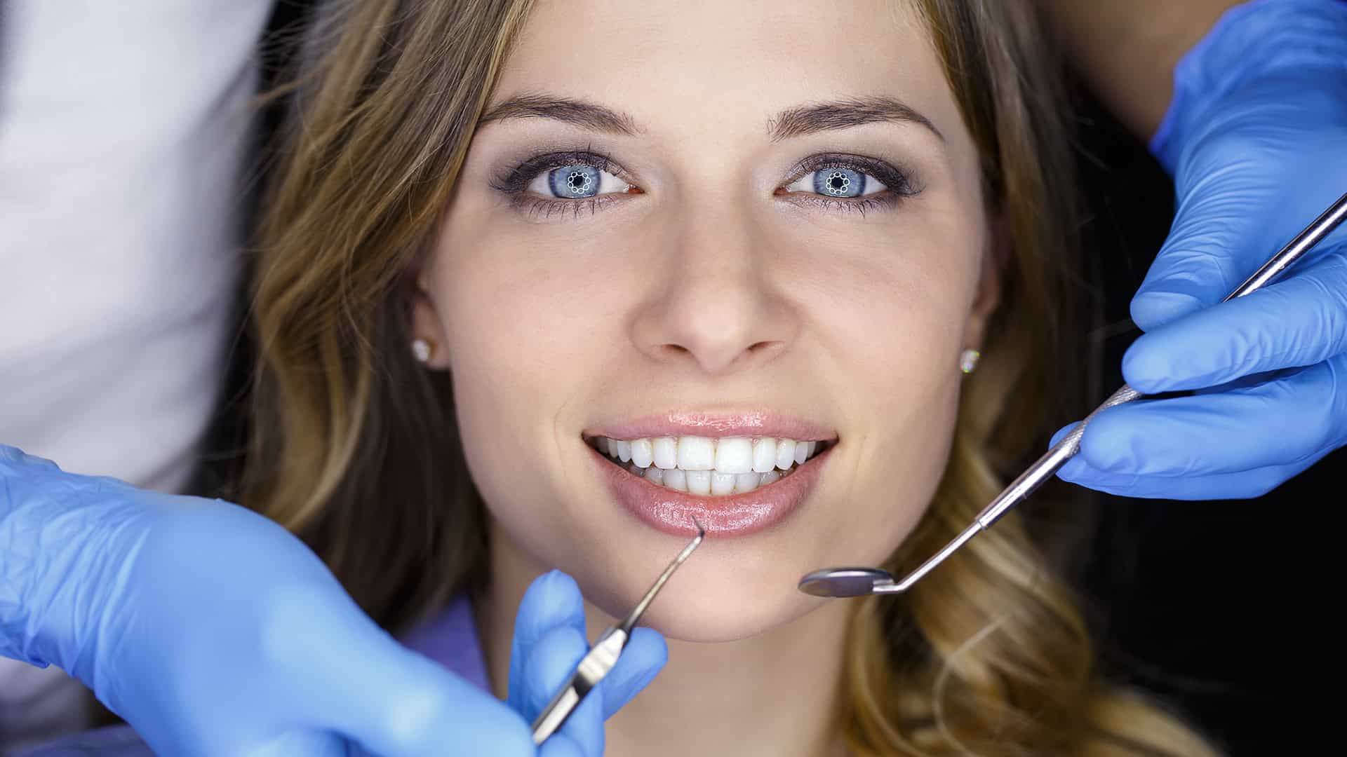 Woman Smiling With Veneers
